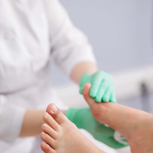 Pure Medical - Treating a Diabetic Foot Ulcer