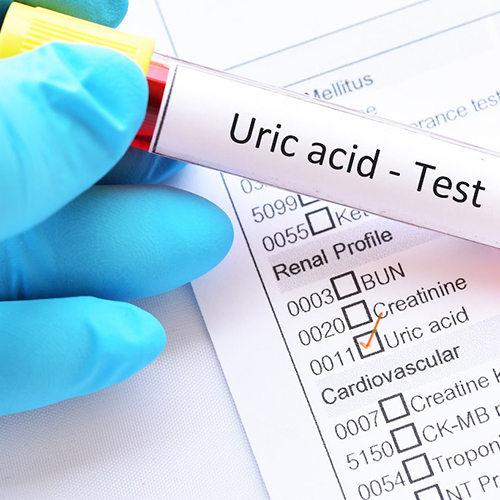 uric acid Test Mobile