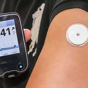 Continuous Glucose Monitoring
