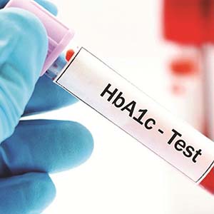 Haemoglobin A1c (HbA1c) testing