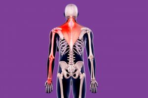 Musculoskeletal Pain