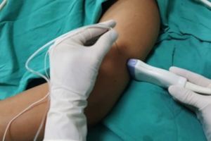 Nerve Blocks