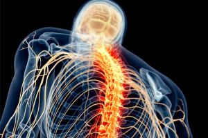 Nerve Pain