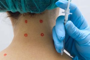 Trigger Point Injection