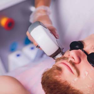 Pure Medical Spa - Face Laser Hair Removal