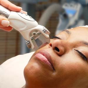 Pure Medical Spa - Laser Treatments