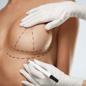 Breast Augmentation with lift - Pure Medical