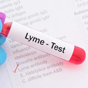 Lyme Disease Testing - Pure Medical