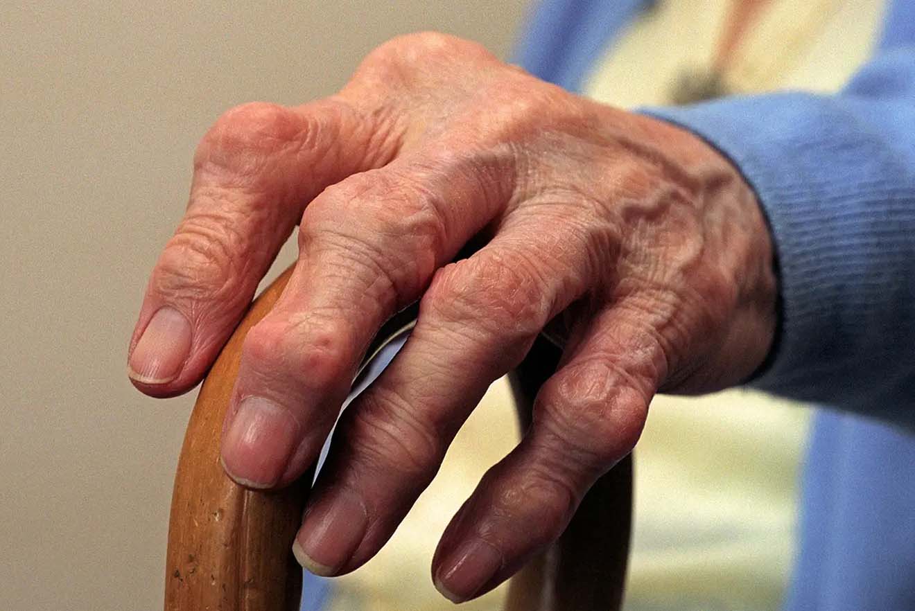 Arthritis Centre Arthritis Information, Advice & Support Pure Medical