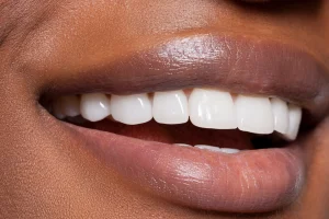 Healthy Teeth