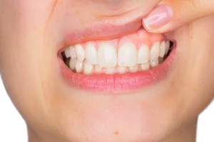 Maintain Gum Health