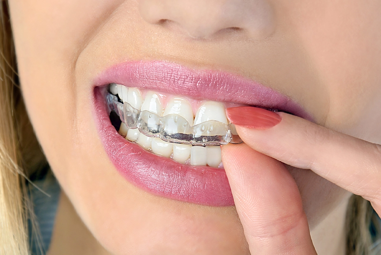 6 Best Remedies to Stop Teeth Grinding (Bruxism) Pure Medical